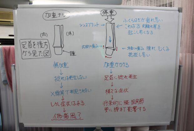足首の歪みを甘くみないで。(>_<)のイメージ画像