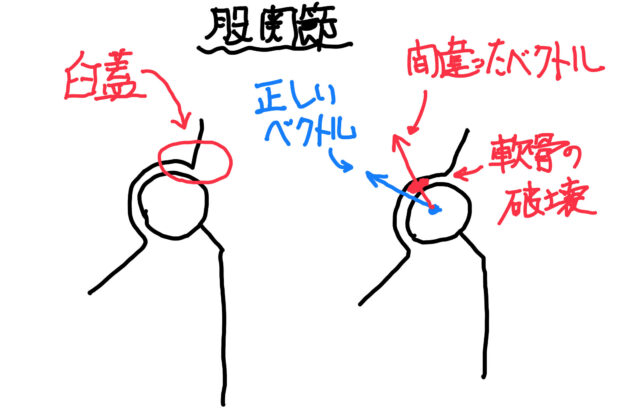 なぜ？治らない！股関節の痛み。のイメージ画像