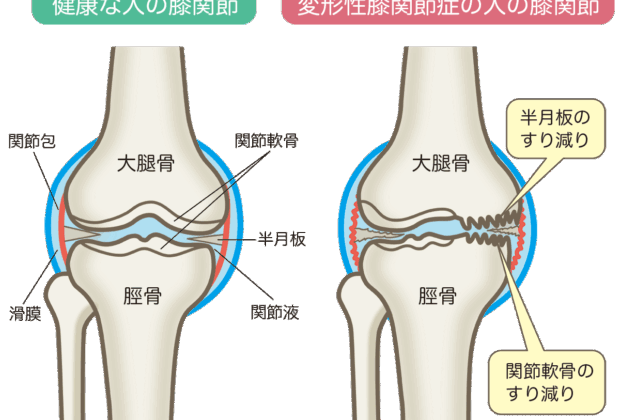 「もう少し早く来て下されば…」のイメージ画像