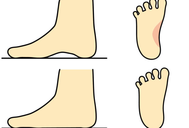 偏平足ですけど、なにか？のイメージ画像