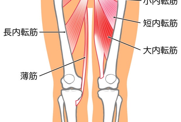 内ももの痛み。のイメージ画像