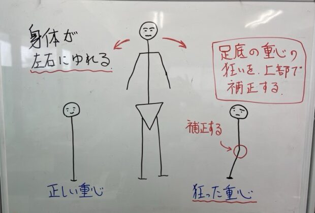 歩行時に左右に揺れる人のイメージ画像