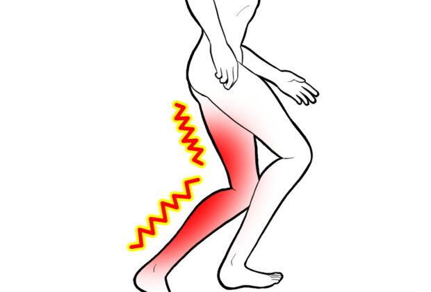 脚の裏側の張りや痛みのイメージ画像