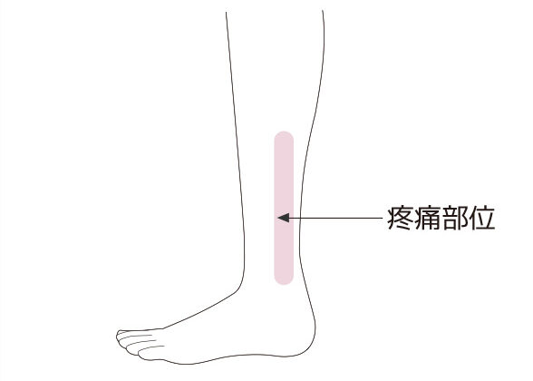 下腿のすね周辺の痛みのイメージ画像