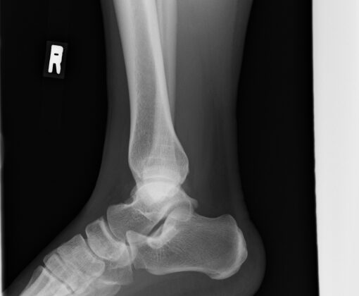Ｘ線,CT,MRI等に映らない原因不明の症状。(足首)のイメージ画像