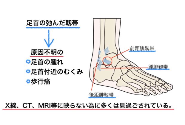 Ｘ線,CT,MRI等に映らない原因不明の症状。(足首)のイメージ画像