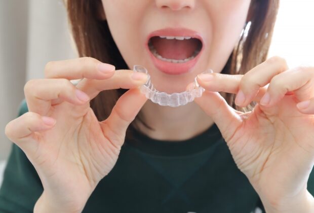奥歯の噛み締めのイメージ画像