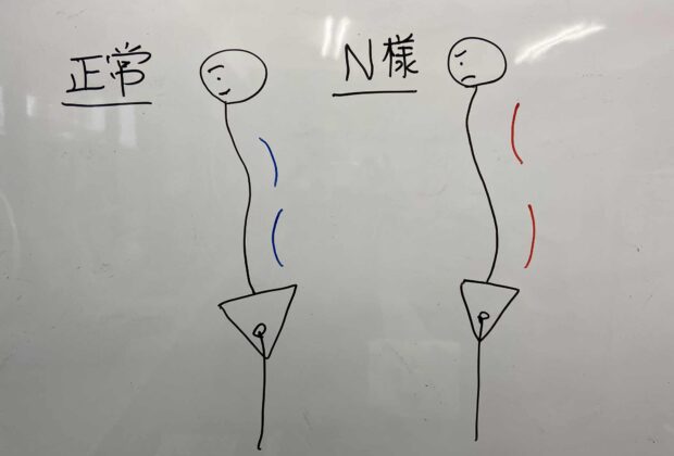 N様40代女性　肩首の痛み（特に朝がきつい）のイメージ画像