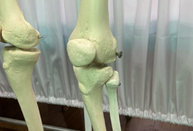 「ひどくなる前に手術をしましょう」？のイメージ画像