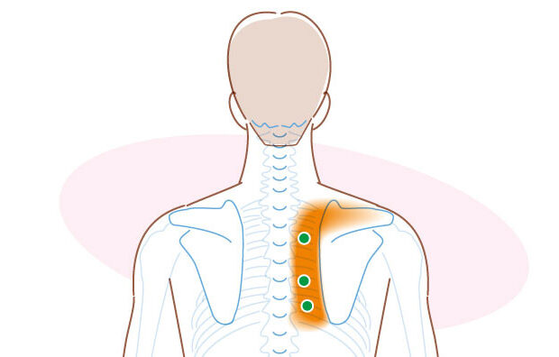 肩甲骨内側の痛みのイメージ画像