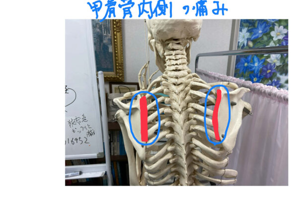 肩甲骨内側の痛みのイメージ画像