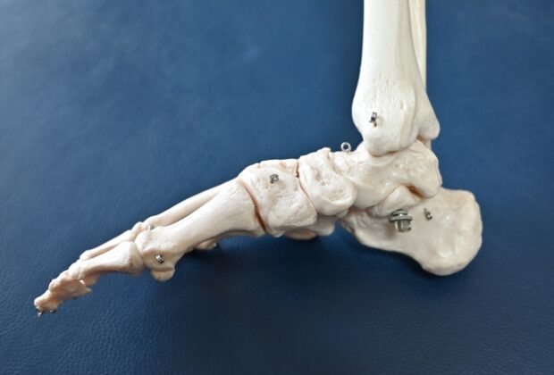 足底の形の沿った靴の弊害のイメージ画像