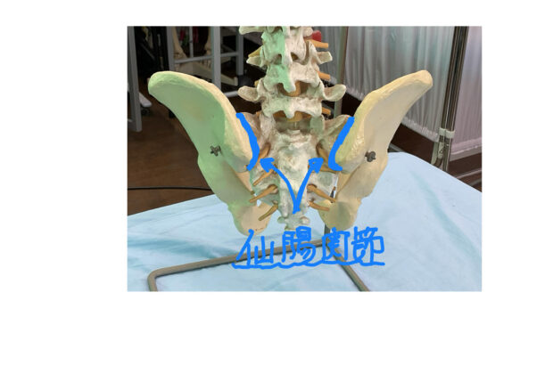ギックリ腰のイメージ画像