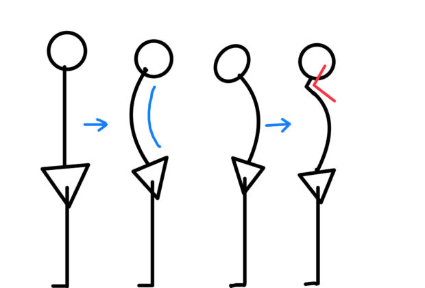 頸椎狭窄症の原因のイメージ画像