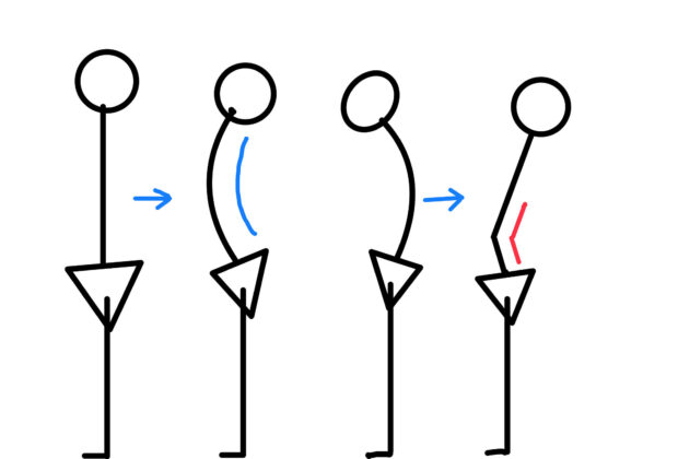 腰椎狭窄症の原因のイメージ画像