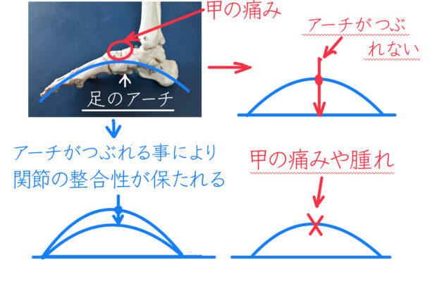 足の甲の痛みのイメージ画像