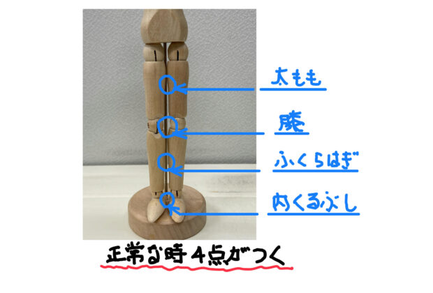 O脚の矯正についてのイメージ画像