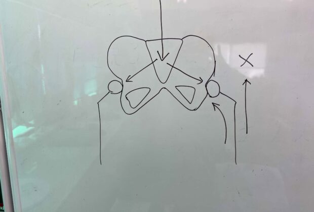 治らないのは何故？（股関節痛）のイメージ画像