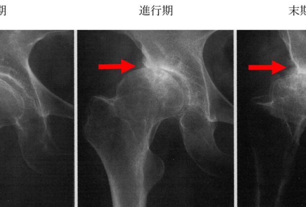「まだ変形は無いので様子を見ましょう。」のイメージ画像